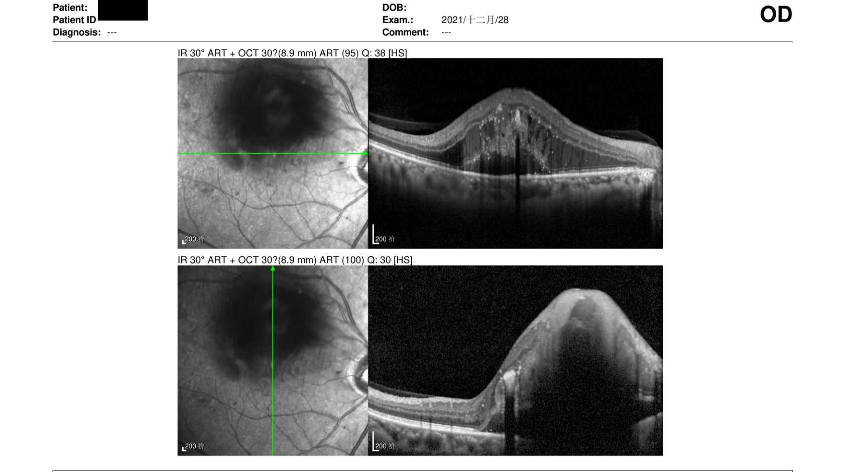 原始文件第 1 页