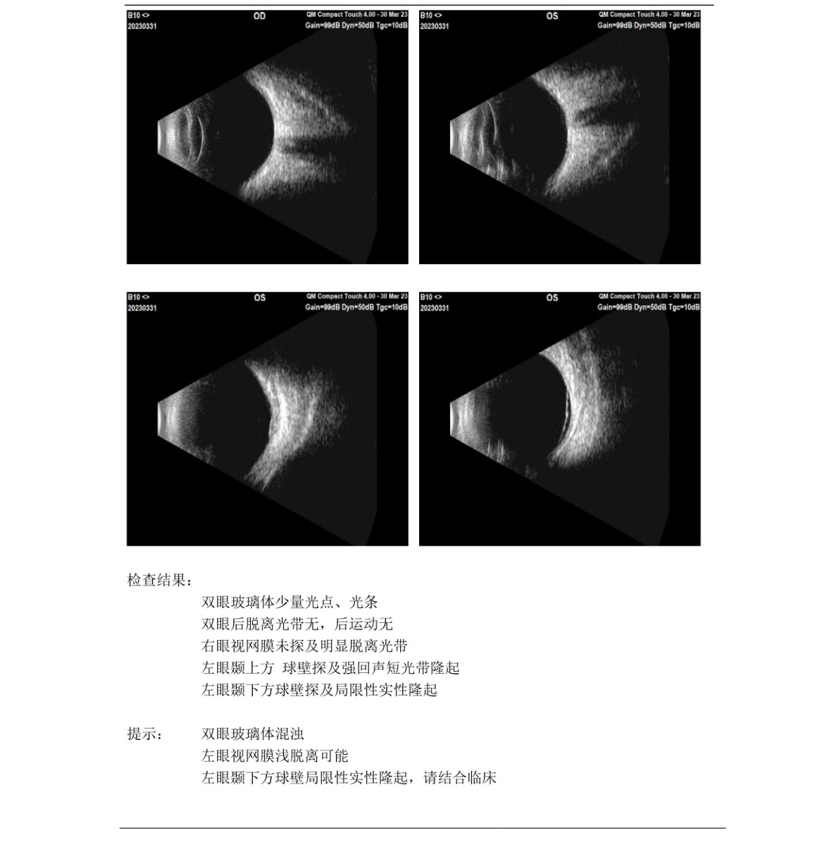 原始文件第 1 页