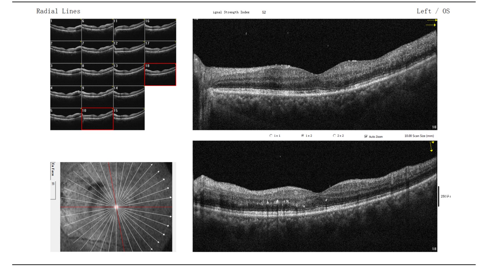 原始文件第 1 页