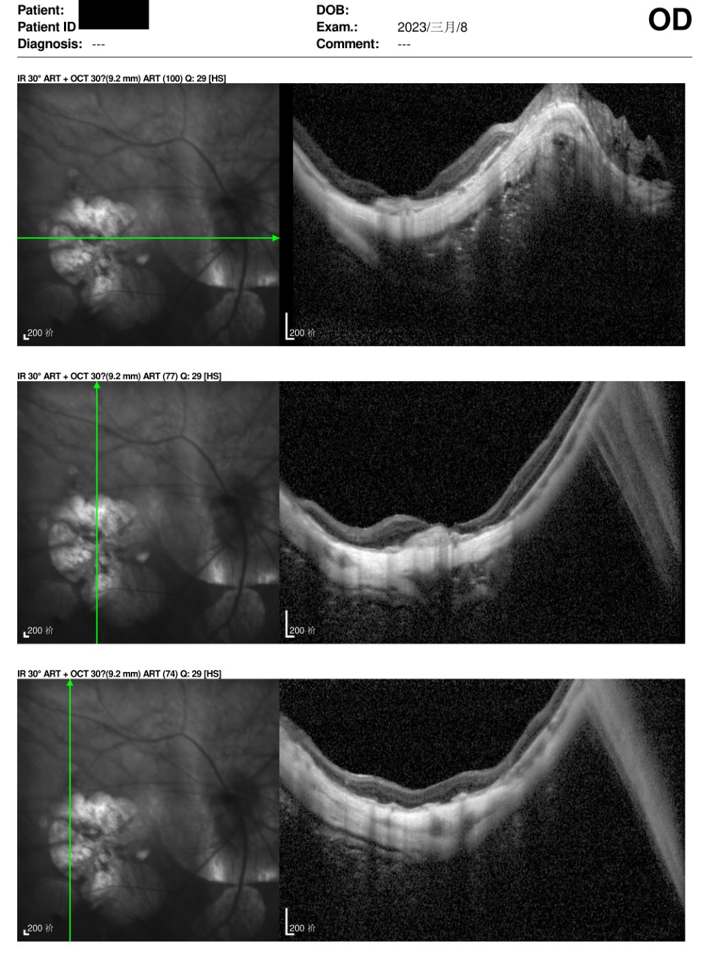 原始文件第 1 页