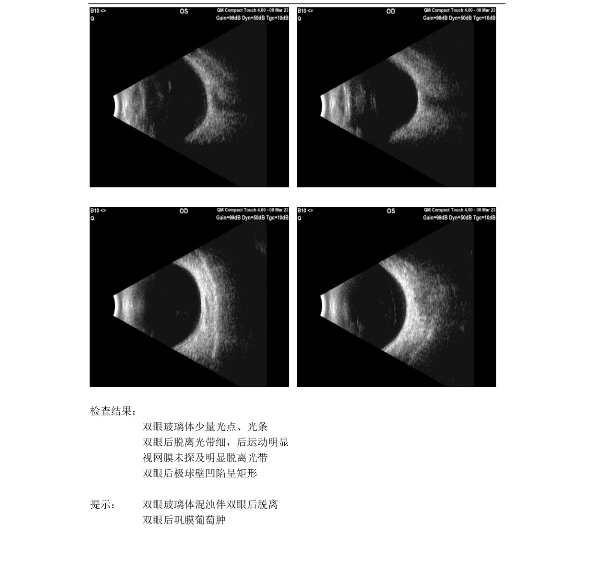 原始文件第 1 页
