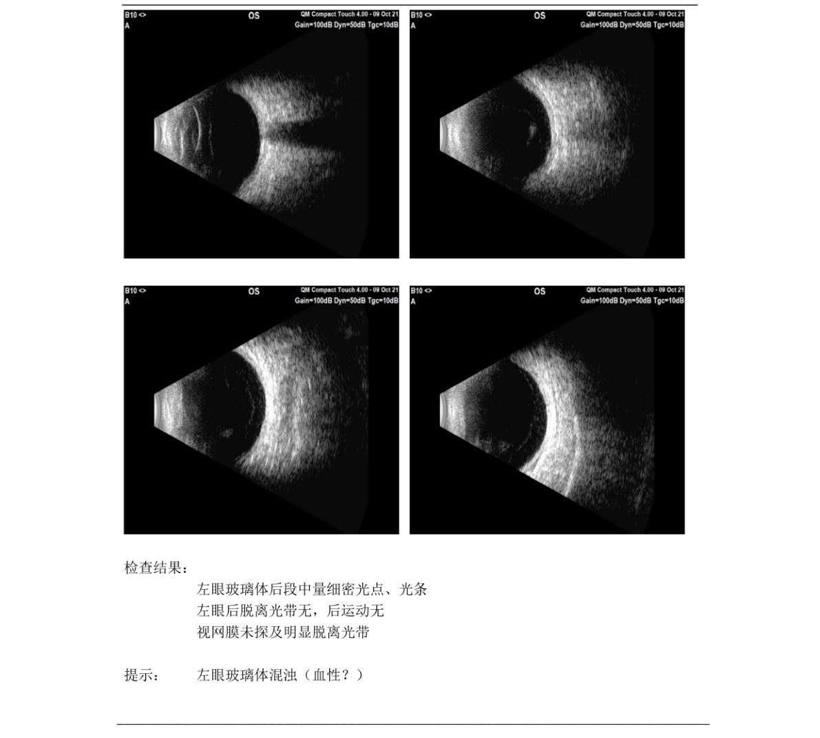 原始文件第 1 页