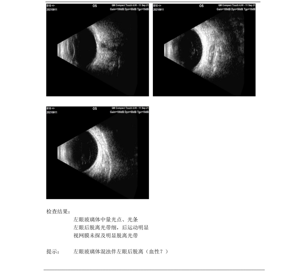 原始文件第 1 页