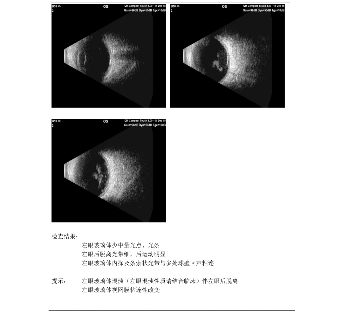 原始文件第 1 页